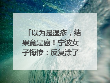 以为是湿疹，结果竟是癌！宁波女子悔惨：反复涂了一年药膏都没好！很多患者首诊都去了皮肤科