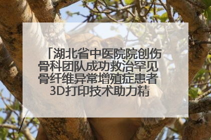 湖北省中医院院创伤骨科团队成功救治罕见骨纤维异常增殖症患者 3D打印技术助力精准矫形手术